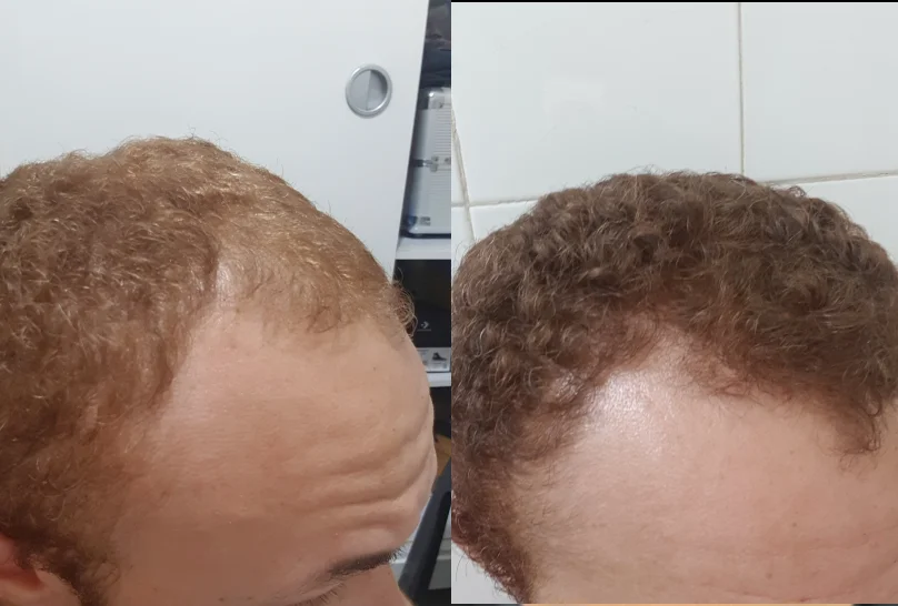 Antes e Depois 3