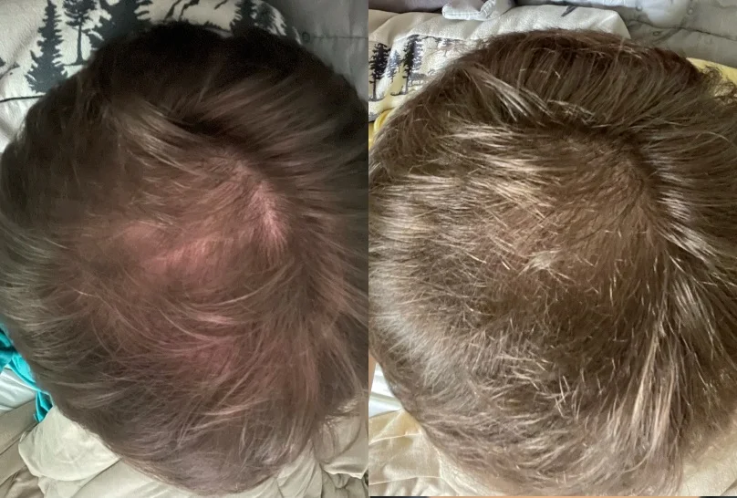 Antes e Depois 1