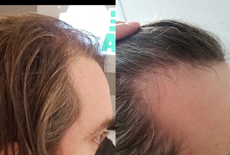 Antes e Depois 2