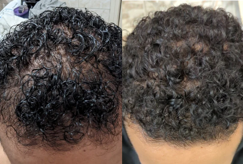Antes e Depois 4