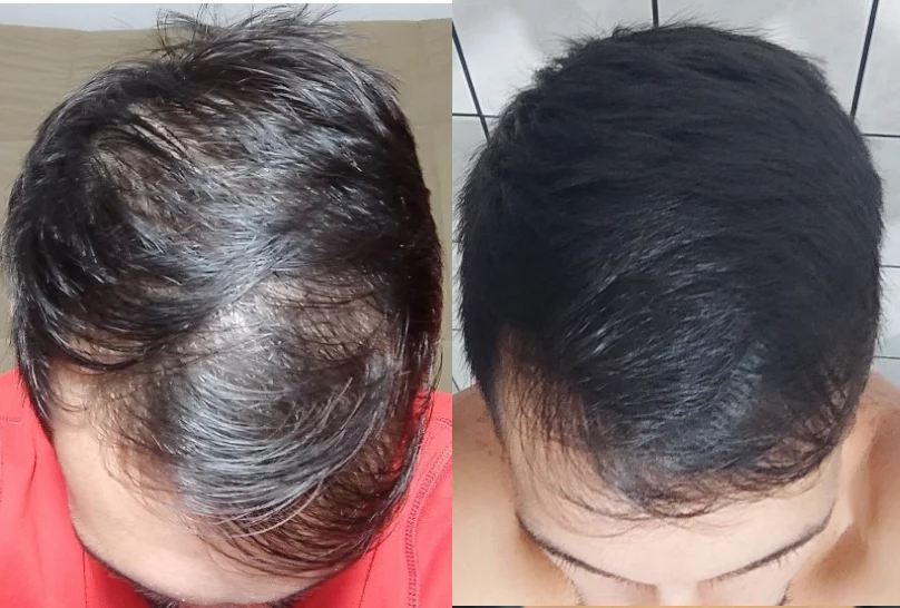 Antes e Depois 7